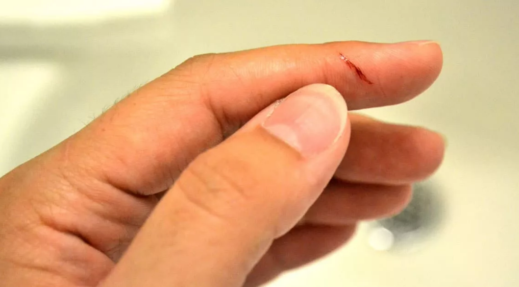 поранить указательный палец ножом