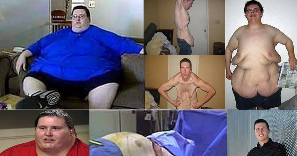 10 самых невероятных рекордов потери веса